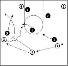 Defending the Pick and Roll